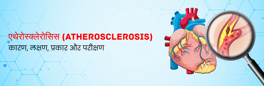 एथेरोस्क्लेरोसिस: कारण, लक्षण, प्रकार और परीक्षण